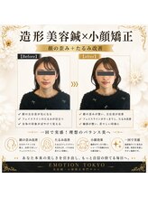 エモシオン トウキョウ(EMOTION TOKYO)/造形美容鍼×小顔矯正