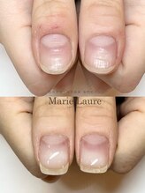 マリーロール 梅田店(Marie Laure)/自爪育成/深爪矯正/ネイルケア