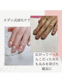 矯正してもまた折れたらダメです