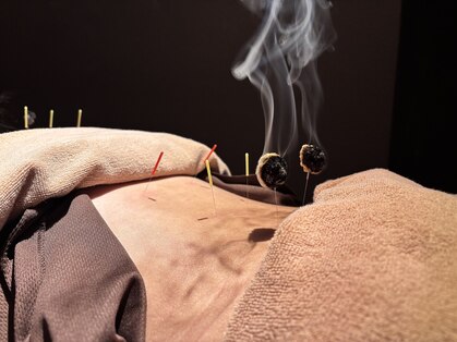 森の鍼灸院 京都下京町家院の写真