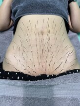 高宮レディース鍼灸整骨院/妊活施術も対応