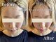シャインアン(Shine'an)の写真/ネイルサロン併設だから気軽に行ける♪おしゃれなサロンでフェイシャルとネイルの自分メンテナンス◎！