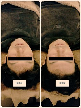 吉川美南ライフ整骨院/40代男性