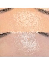 ソマリ(SOMALI)/毛穴レスな艶玉肌へ