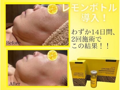 美ネージュの写真