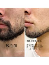ヴァイオス 八王子(VIOS)/【デザイン】デザイン髭も可能！