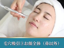 シャルトルズ 西宮北口店/吸引　３