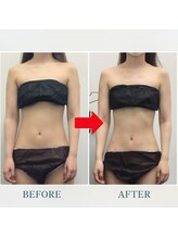 ステイゴールド美容整体院(STAY GOLD)/整体で二の腕とくびれがスッキリ