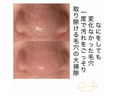 ラウレア(Laule’a)の写真