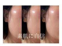 エクラ(eclat)の雰囲気（艶肌が手に入る）