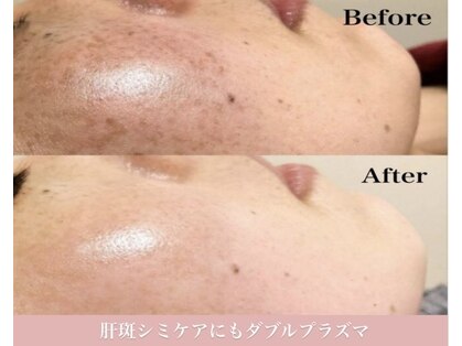 イリゼ(iriser)の写真