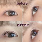 プローサム(Prorsum)