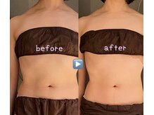 ボディスタイリング(Body Styling)の雰囲気（エレクトロハンドの微弱電流マッサージ痩身・小顔★）