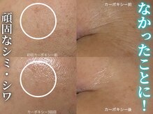 ハニエル(Haniel)の雰囲気（諦めないで大丈夫！頑固なシミ・シワをケアして目指せ-10歳☆）