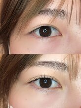 リガール(LIGAR)/Before→After ☆