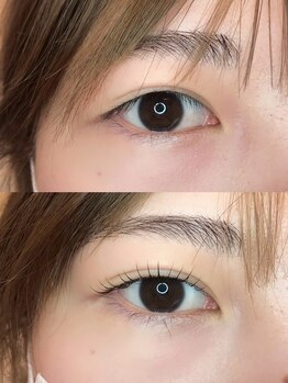 リガール(LIGAR)/Before→After ☆