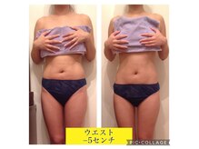 リブラザバランス(LIBRA the balance)の雰囲気（ビフォー・アフター　痩身/小顔/ヘッドスパ/ブライダル/リンパ）