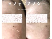 セレーノ/ビフォーアフターのご紹介