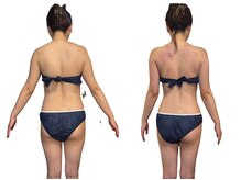 アンドゥ 津田沼(Undo)/年齢は背中に！大人こそ背中ケア