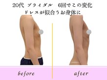 ビーハピネス 京都西院(B-Happiness)/20代ブライダル