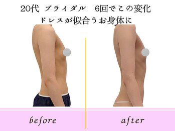 ビーハピネス 京都西院(B-Happiness)/20代ブライダル