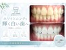 【まずは体験♪|美白効果&ケア】 1~2トーンUP ¥3,500