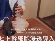 ポエーシス(Po A Sis)の雰囲気(専門機関で活用の臍帯由来エクソソームで細胞から整えます♪)