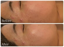 ブリエ(Briller)/シルクパウダー1回目♪