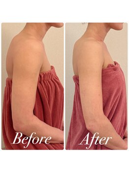 ユーブルーム(youbloom)/美ボディーライン★二の腕変化★