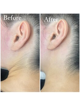 ホワイトワックス 京都四条烏丸(WHITE WAX)/うなじ脱毛☆