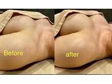 ベッピン(Beppin)/ブライダルまでに最高に綺麗に♪