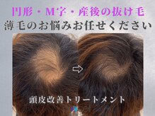 ワーチ(WARCH)