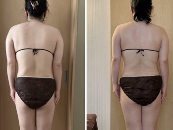 マイティー整骨院 ココア(CoCoa)/活性リンパ洗浄