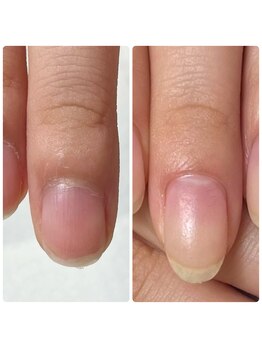 サエコ ネイル (3e5 nail)/◆紗栄子流 美爪育成◆