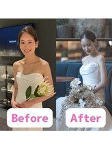 ボディキュア ブライダル美容整体 大阪梅田/すっきり美ボディに/大阪/北新地