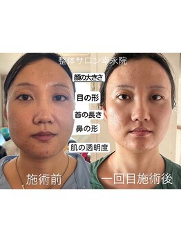 小顔になりたい