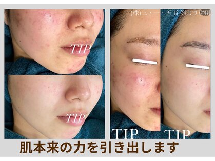 ラフルール(La Fleur)の写真