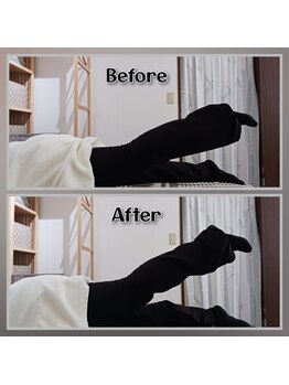 ぷめはな整体の写真/足のむくみは内臓調整から！内臓の位置を戻し足への血流アップを実感！◎