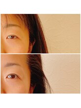 ベルヴィ(Belle美)/1回で目の開きが一目瞭然！！