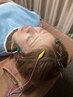 初回限定！電気で引き上げる美容鍼！　　　　　￥７１５０→５９８０