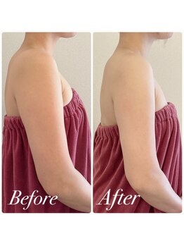 ユーブルーム(youbloom)/美ボディーライン★二の腕変化★