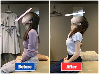 ナオル整体 仙台院(NAORU整体)/肩こり、首こりの改善!