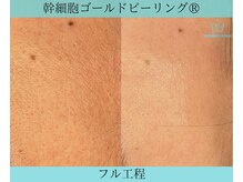 リメイククリニカルビューティー(Remake clinical beauty)/元気のないお肌も