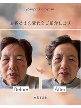 ヨサパーク ゴールデンツリー 浦安本店(YOSA PARK GordenTree)/水素まみれでリフトアップ↑↑