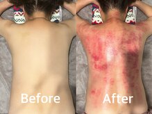 もっこり首のお悩みもクラッシュで解決♪