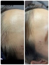 セカンドボックスブルーム(2nd Box BLOOM)/オデコWax