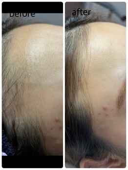 セカンドボックスブルーム(2nd Box BLOOM)/オデコWax