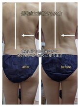 紬(TSUMUGI)/腰痛の原因、背骨の歪みも