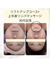 ミヤビ(MIYABI)/1回の施術効果