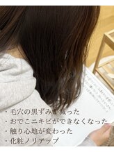 ソワ 吉塚店(soi)/ニキビ改善！